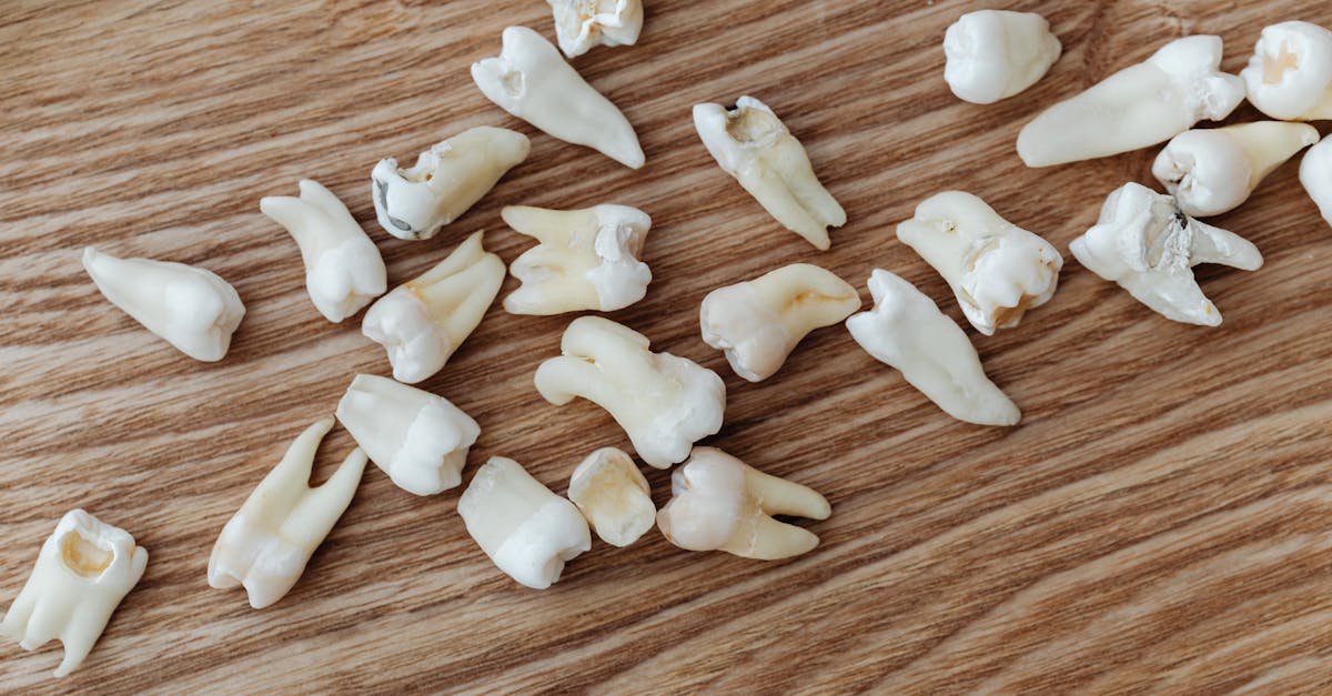 découvrez des solutions efficaces pour récupérer vos données perdues, améliorer votre bien-être émotionnel ou retrouver votre équilibre dans la vie quotidienne. explorez nos conseils pratiques et ressources pour un processus de récupération réussi.