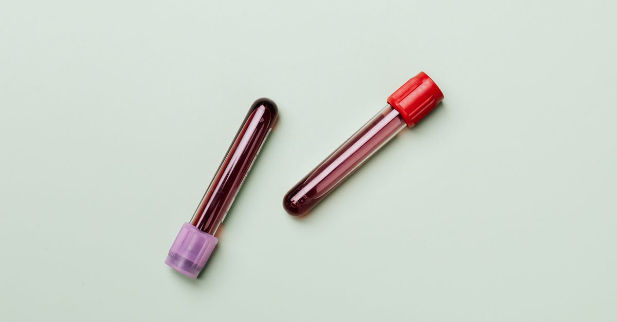 découvrez tout ce que vous devez savoir sur les tests sanguins : leur importance, les types d'analyses, comment se préparer et interpréter les résultats. restez informé sur votre santé grâce à nos conseils pratiques.