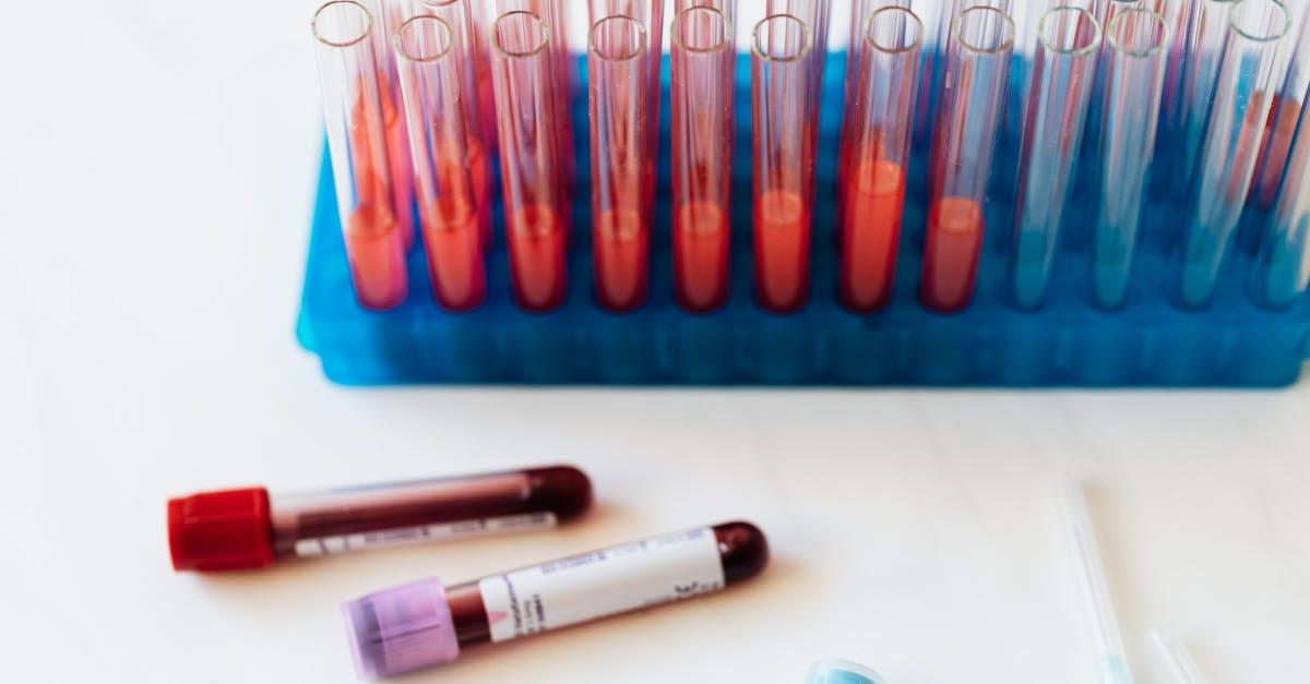 découvrez tout ce qu'il faut savoir sur les analyses sanguines : leur importance, les types de tests disponibles et comment ils peuvent aider à diagnostiquer vos problèmes de santé. informez-vous sur le processus, les résultats et ce que cela signifie pour votre bien-être.